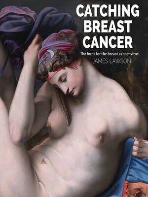 cover image of Catching Breast Cancer